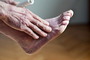 What Causes Poor Foot Circulation?
