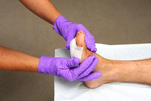 Managing Chronic Wounds